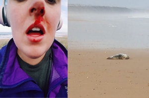 女子從一群小屁孩手裡救出幼年海豹，反被打到鼻環穿孔狂流血！