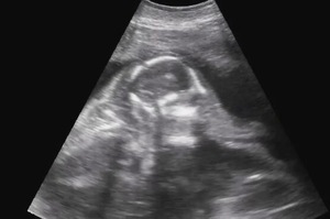 「小生命的奧妙」美國動物園公佈母象產檢的超音波畫面，記錄象寶寶的成長過程
