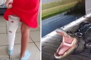 小女孩戲水到一半「整隻腿被鱷魚狠咬」，沒想到她脫困的方式竟然是...插牠鼻孔？